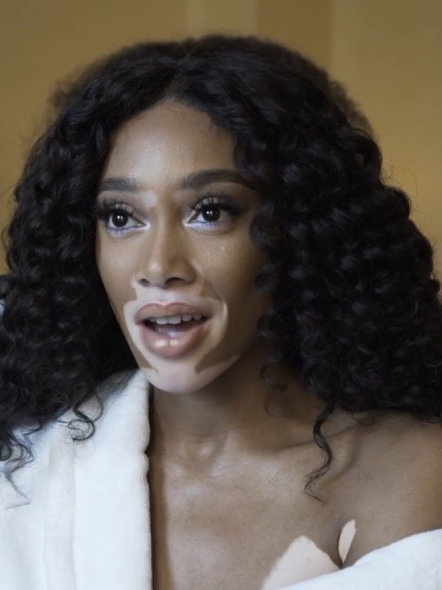 Close-up beauty portrait of Winnie Harlow with curly hair, the vitiligo visible across her face