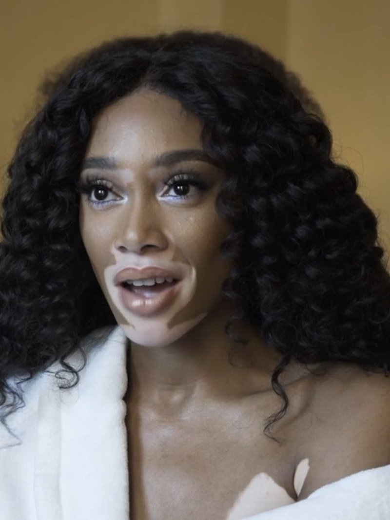 Winnie Harlow