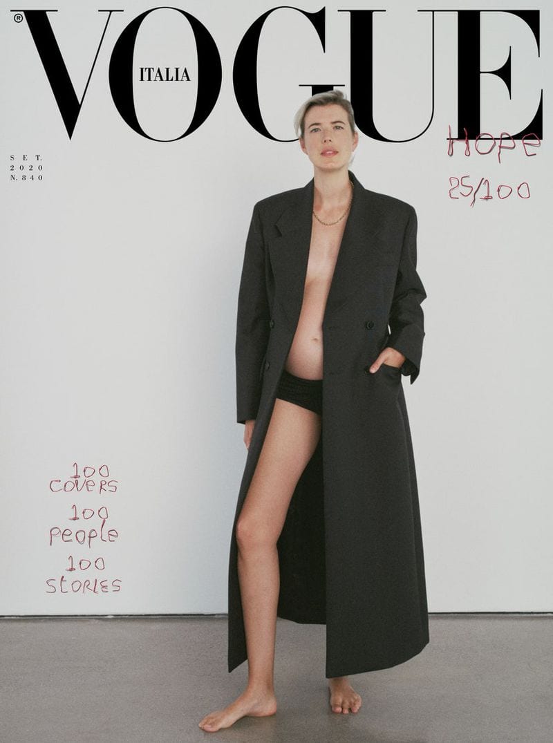 Agyness Deyn — photo 9