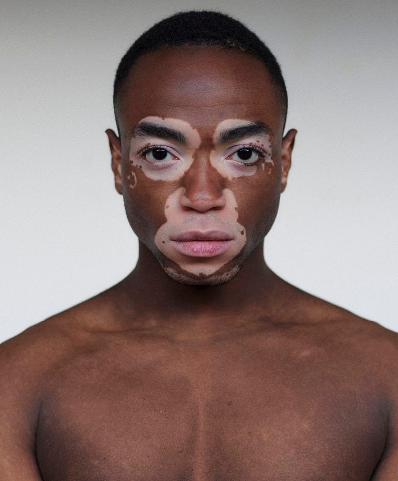 Terence Munzemba — photo 5