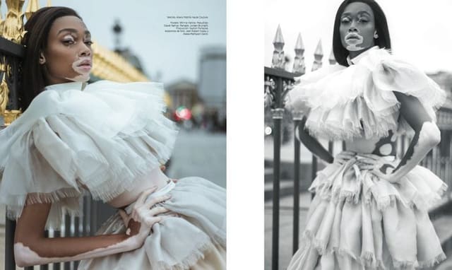 Winnie Harlow — Harper's Bazaar Mexico