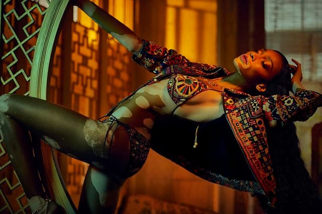 Winnie Harlow — Vogue India