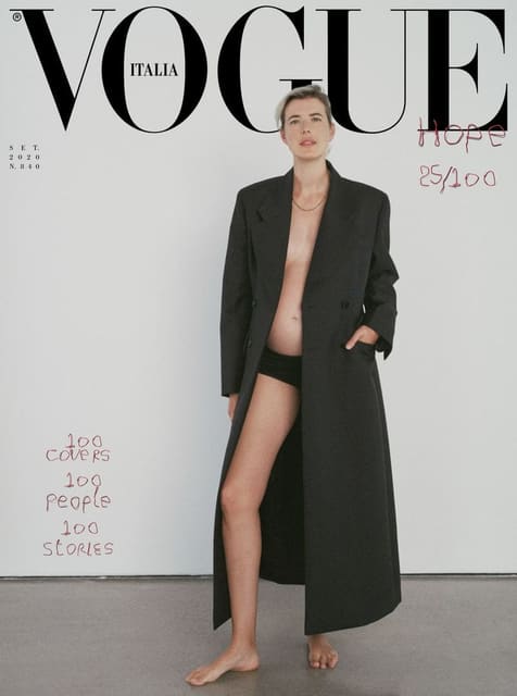 Agyness Deyn — 9