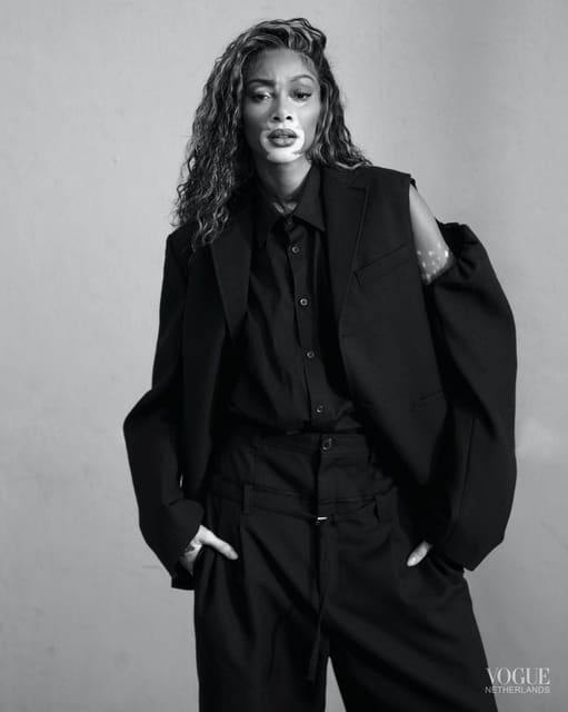 Winnie Harlow by Nikki Esser — Vogue Netherlands