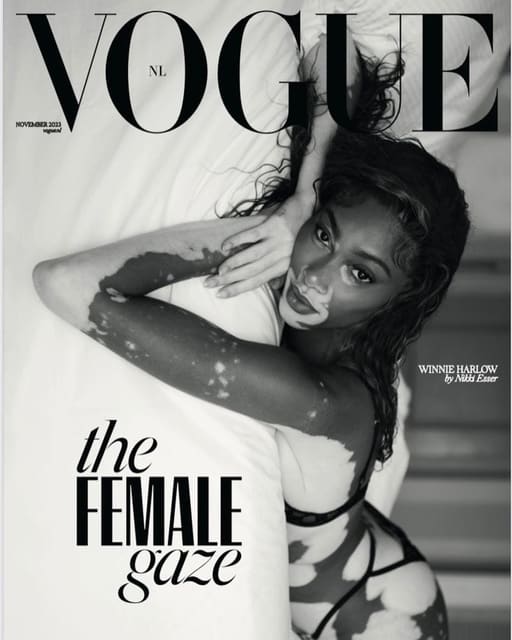Winnie Harlow