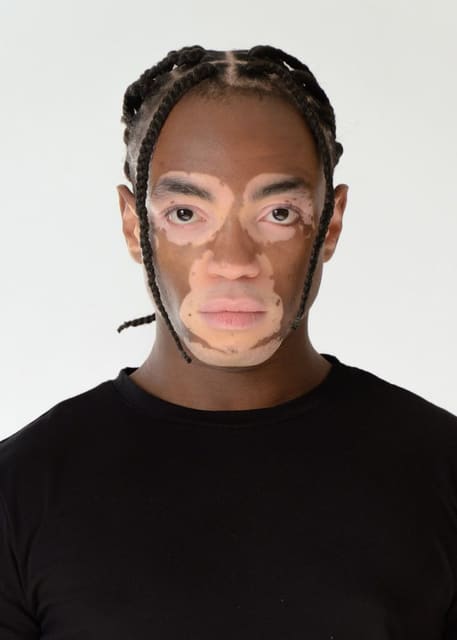 Terence Munzemba