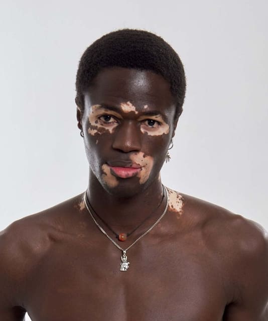 Alpha Ndoye
