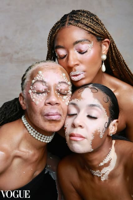 Vitiligo girls — Vogue.it