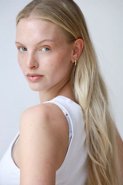 Alison Noa Uetz