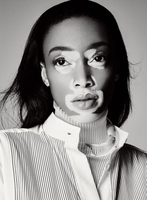 Winnie Harlow — Sunday Style Australia